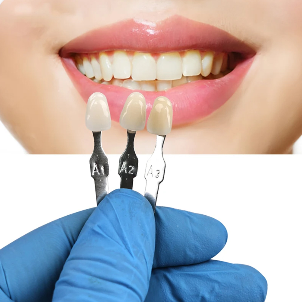 VITA 16 Colors Teeth Shade Gui - Teeth Whitening Kit Professional ulasan dan harga