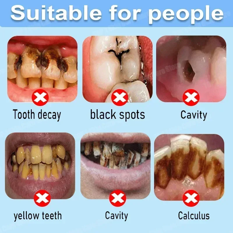 Anti Decay Toothpaste Repairs  - Teeth Whitening Foam ulasan dan harga