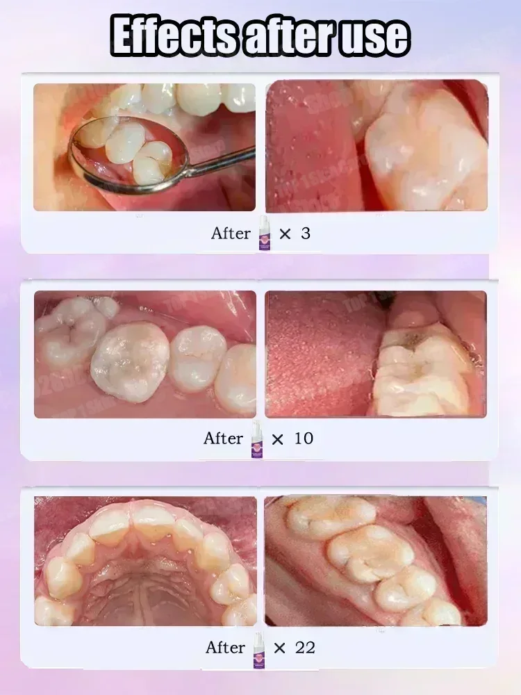 Hot sales Best-selling, Scient - Teeth Whitening Toothpaste ulasan dan harga