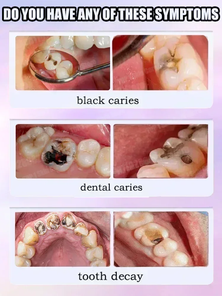 Hot sales Best-selling, Scient - Teeth Whitening Toothpaste ulasan dan harga