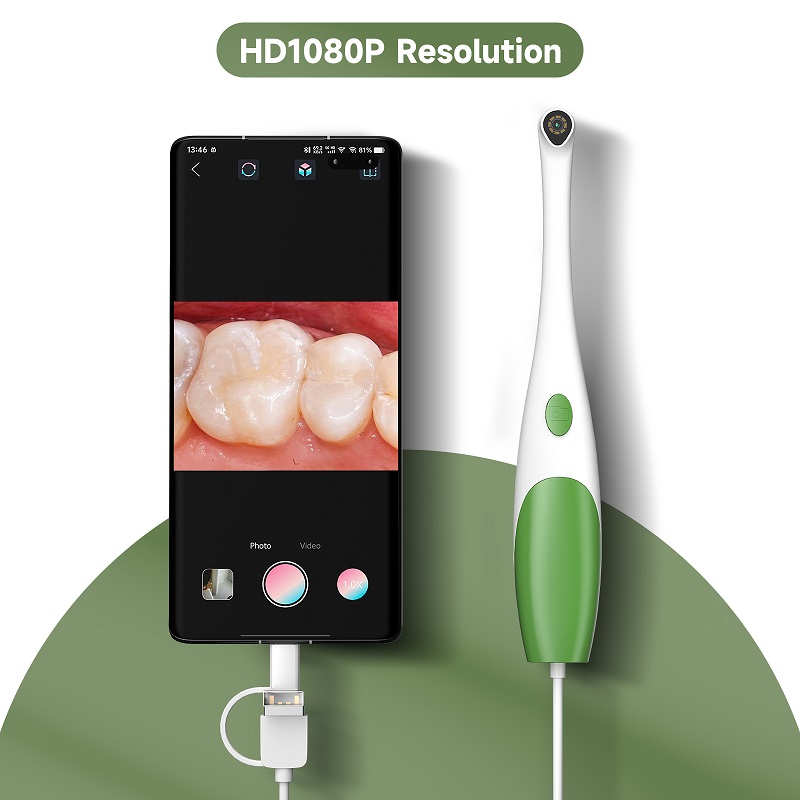 TYPE-C Oral Endoscope Handheld - Teeth Whitening Video ulasan dan harga