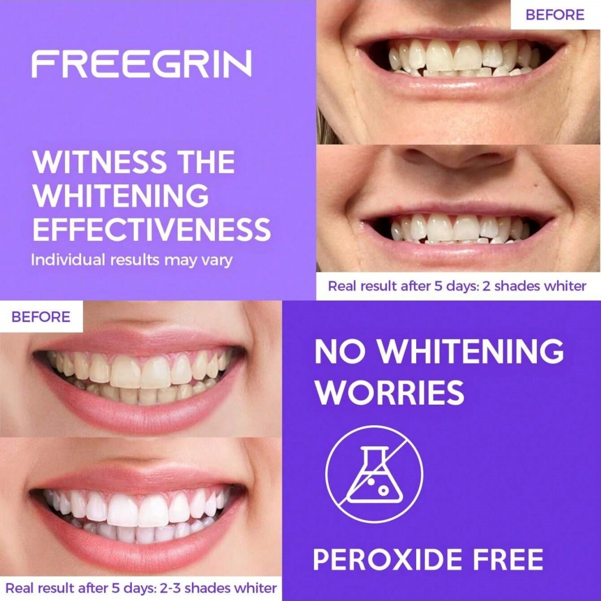 Deluxe Whitening Teeth Sticker - Teeth Whitening Before And After ulasan dan harga